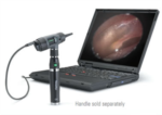 Welch Allyn Digital MacroView Otoscope