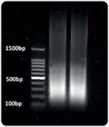 Figure 1. Chromatin was sheared using a Bioruptor for 30-second bursts with 30-second intervals on ice at a power setting of 3 for 15min so that desired fragment lengths between 1 and 500bp were obtained.