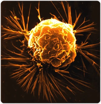 Breast cancer cell