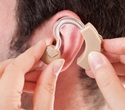 International experts publish guidelines on the administration of gene therapy for hereditary hearing loss