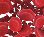 Hemoglobin emerges as a natural antioxidant defense in the brain