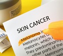 Lower dose of immunotherapy for malignant melanoma improves results