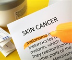 Melanoma cases climb amid declining sunscreen use in Canada