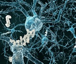 Understanding Alzheimer’s Disease Through Genomics and Proteomics