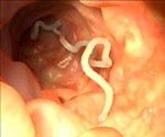 Man dies after developing tapeworm tumors