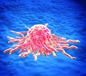 Web-based cytometry atlas reveals immune signatures across pancreatic cancer treatments
