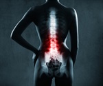 Minimally invasive spine surgery
