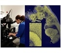 Mesolens microscope uses Prior Scientific's precision stages and focusing systems for 3D imaging of biomedical specimens
