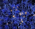 New Theory About Alzheimer's Disease