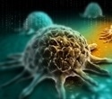 Durvalumab extends survival in small cell lung cancer but raises cost concerns