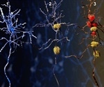 Health authorities reviewing scientific data from trials evaluating Alzheimer's treatment, Reminyl
