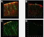 Using X-CLARITY™ Mounting Solution for Efficient RI Matching of Cleared and Immunolabeled Tissues