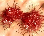 New insights into cancer cell signaling could help prevent metastases