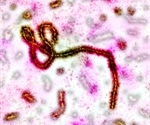 Study shows clinical and psychosocial consequences following survival of Ebola infection
