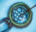 Maternal age drives embryo arrest independently of chromosomal errors