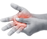 Concomitant diabetes associated with osteoarthritic hand pain