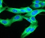 Researchers discover that DNA fragments destroy melanoma cells