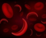 Children with sickle cell disease are living longer, dying less often from their disease