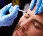 Botox controls excess sweating as well as ironing out those wrinkles