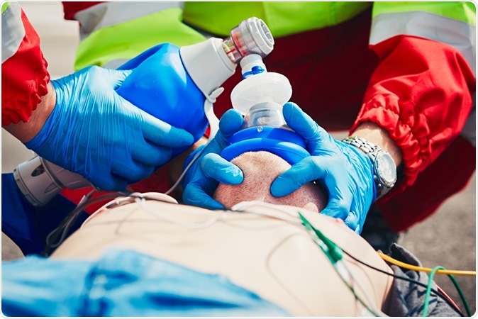 Cardiopulmonary resuscitation. Image Credit: Jaromir Chalabala / Shutterstock