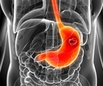 Prolonged use of PPIs linked with two-fold increased risk of stomach cancer, study finds
