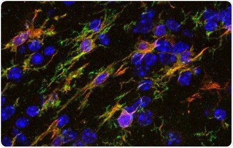Anti-Tmem119 antibody [28-3] – microglial marker (ab209064) Immunohistochemistry (IHC-Fr-frozen sections) of mouse corpus callosum stained using anti-tmem119 (ab209064). Tmem119 is a highly specific cell-surface marker of microglia that is not expressed by macrophages or other immune or neural cell types2.
