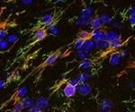 Tools for Detecting Neuroinflammation in Neurodegenerative Diseases