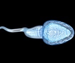 Defects in Jhdm2a gene could be the cause for some cases of male infertility