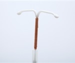 IUD: Advantages and Disadvantages
