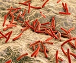 New chink in the cellular armor of tuberculosis (TB) and leprosy
