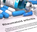 New study reveals silent onset of rheumatoid arthritis