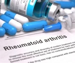 New study reveals silent onset of rheumatoid arthritis