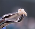 Over-the-counter pain relievers outperform opioids after wisdom tooth extraction