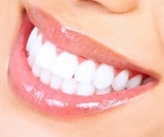 Uneven tooth color matters more than whiteness for young adults