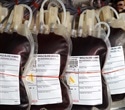 Non-monetary incentives boost blood donation without harming safety