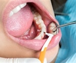 Dental Care During Pregnancy