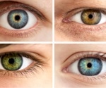 Genetics of Eye Color