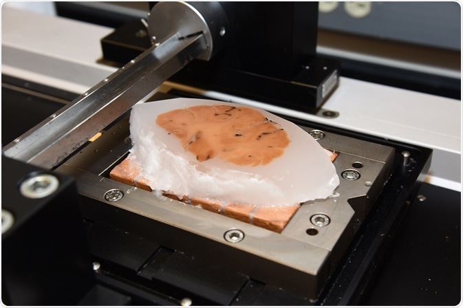 Brain tissue sample in block form ready for sectioning.