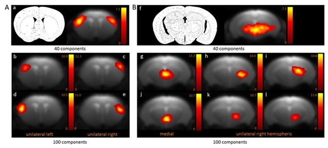 BOLD resting-state fMRI based cortical (A) and thalamic (B) mouse brain functional connectivity clusters, comparatively revealed by 40- (a, f) and 100-ICASSO (b–e and g–l). All images represent spatial color-coded z-maps of the independent components.