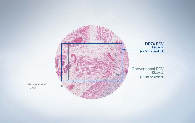 One of the Widest Field of Views Available