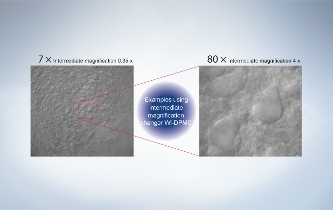 IR-DIC observation, trigeminal motor neuron, Tomio Inoue Ph.D, Department of Oral Physiology, Showa University