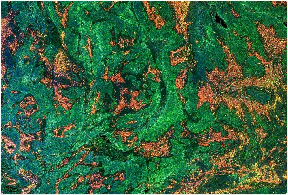 Tissue sample stained using multiple fluorescently labeled antibodies - image generated by Carl Dupont