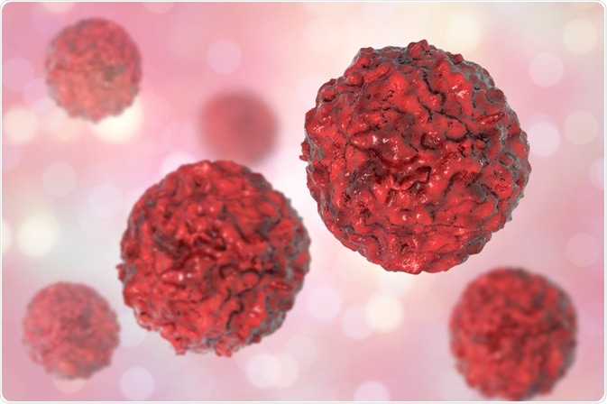 Cancer cells - Kateryna Kon