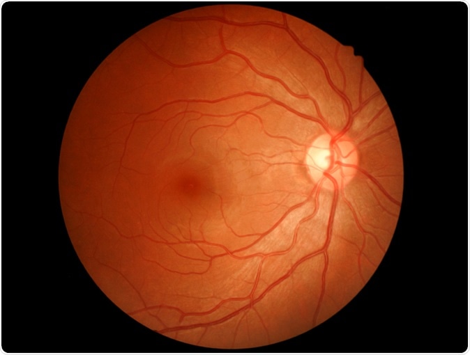 Image Credit: Memorisz / Shutterstock