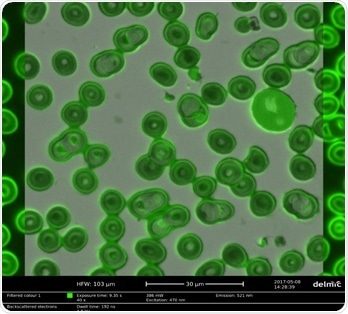 Correlative light and electron microscopy image of red blood cells stained with a hydrophilic fluorescent dye.