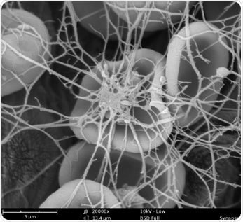 Insights into blood clot formation using an SEM.