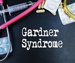 Gardner's Syndrome Management