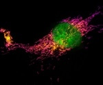 Super-resolution microscopy provides insights into cells' amazing flexibility