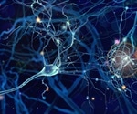 Discovery of unique brain cells sheds light on progressive multiple sclerosis