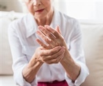 Korean researchers develop 10 minute test for arthritis detection